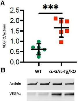 Overexpression of VEGFα as a biomarker of endothelial dysfunction in aortic tissue of α-GAL-Tg/KO mice and its upregulation in the serum of patients with Fabry’s disease
